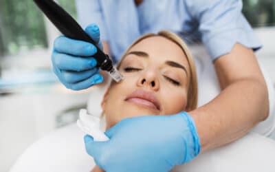Is Microneedling with PRP Right for Your Skin Type?